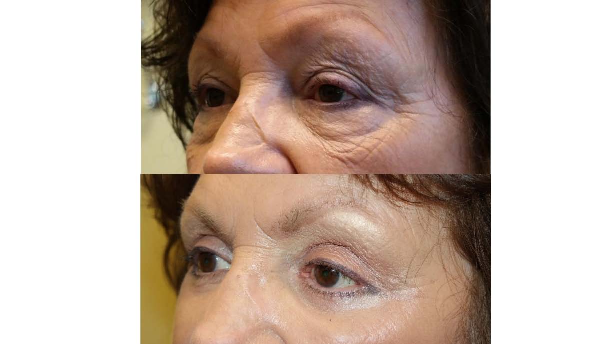 Before and After Skin Treatment