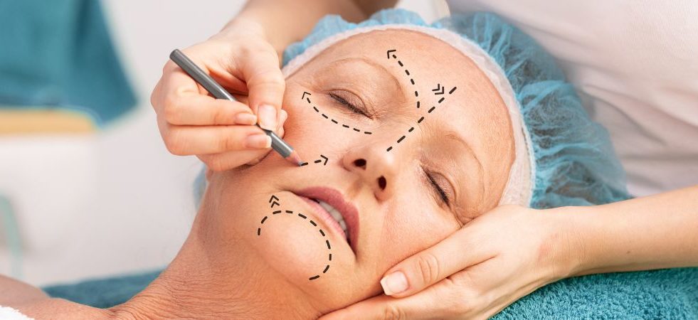 Facial rejuvenation procedure