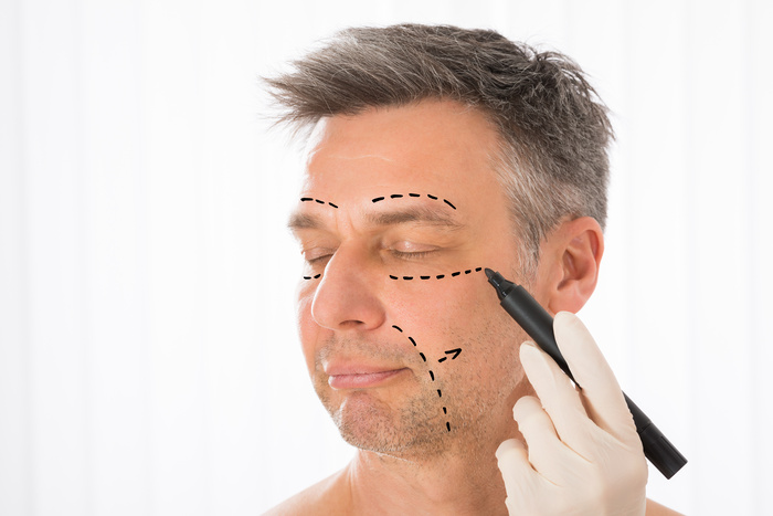 Surgeon Drawing Correction Lines On Man Face