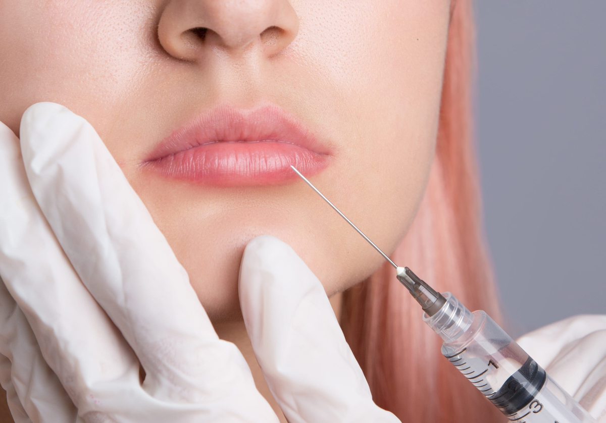 woman getting lip fillers